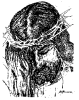 jesus with crown of thorns